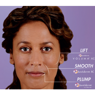Juvederm Ultra XC - Hyaluronic acid Filler (1mL syringe)